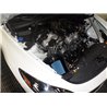 Injen | SP Series Short Ram Intake - Stinger 2.0T 2018-2019