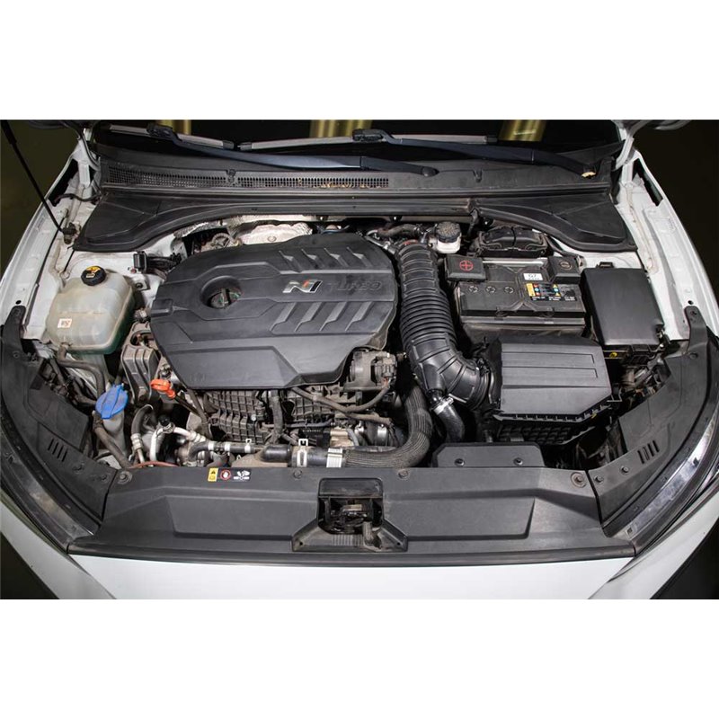 K&N | Charge Pipe Kit - Veloster N 2.0T 2020-2022